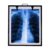 Xray view Box Digital for Clinic LED Premium Single Film with Brightness Adjustment, Black X-Ray Viewer (14x17 inch)