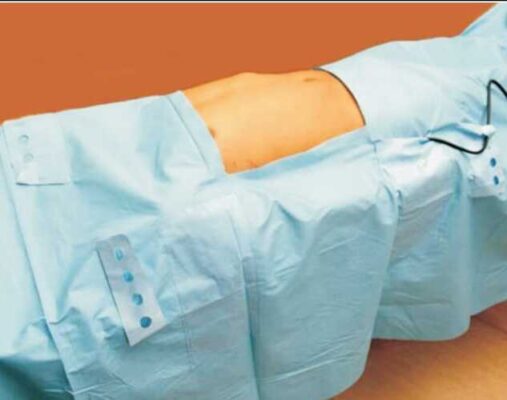 Laparoscopy Drape Sterile with Indicator