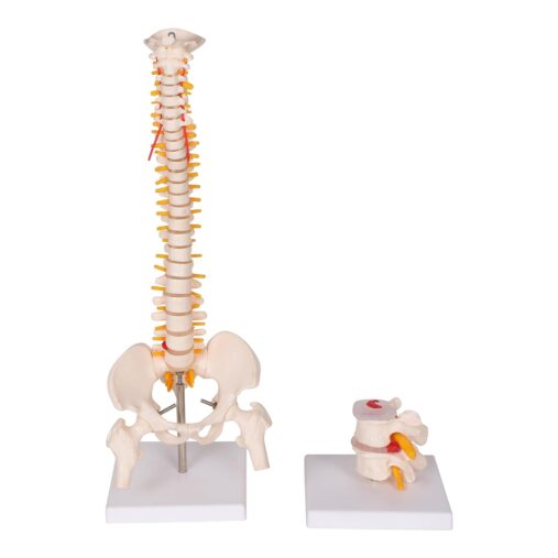 MINI SPINE MODEL WITH VERTEBRAE DEGENERATION MODEL