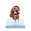 Deluxe Human Kidney Anatomical Model, Demonstrating Normal and Diseased Kidney with Pathologies, Medical Grade Anatomical Model