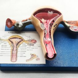 Uterus And Ovary Model Female Reproductive Organ Model Human Anatomy Replica Show Uterus Ovary VaginaTeaching Anatomical Gynecology Doctor Patient Communication Simulation