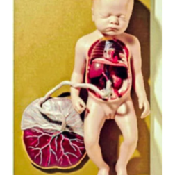 Fetal Circulation Model