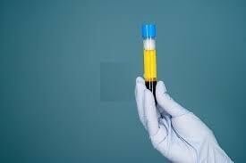 Colorimeter 1 ml Display LCD Display Digital Fully Automatic Photo Colorimeter - Image 5