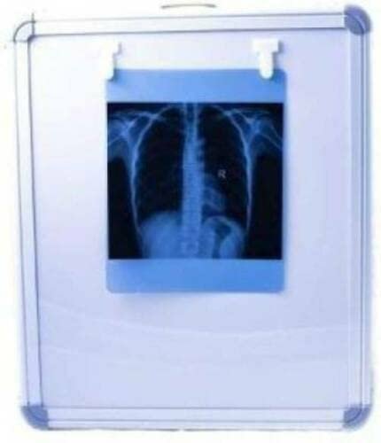 LED X Ray Illuminator View Box with Automatic Film Activation and Variable Brigh - Image 3