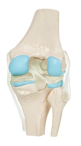 4-Stage Osteoarthritis Anatomical Knee Model on Base - Image 2