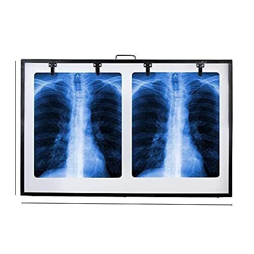 LED X-Ray Black Frame with Dimmer to Adjust Brightness and Automatic Film - Image 4