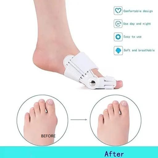 Bunion Splint, Toe Straightener Bunion Corrector for Women - Image 2