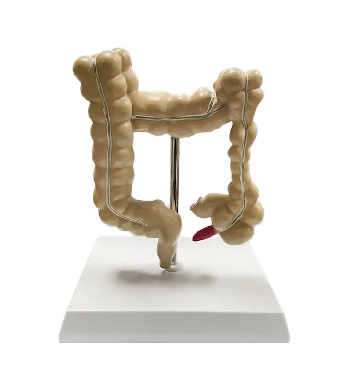 Human Intestine Anatomical Model with Pathologies – Premium Quality - Image 4