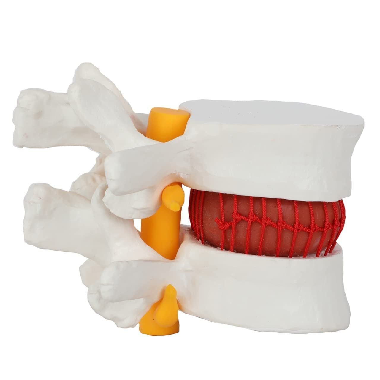Human Lumbar Demonstration Model with Herniating Disc, Varied Textures - Image 5