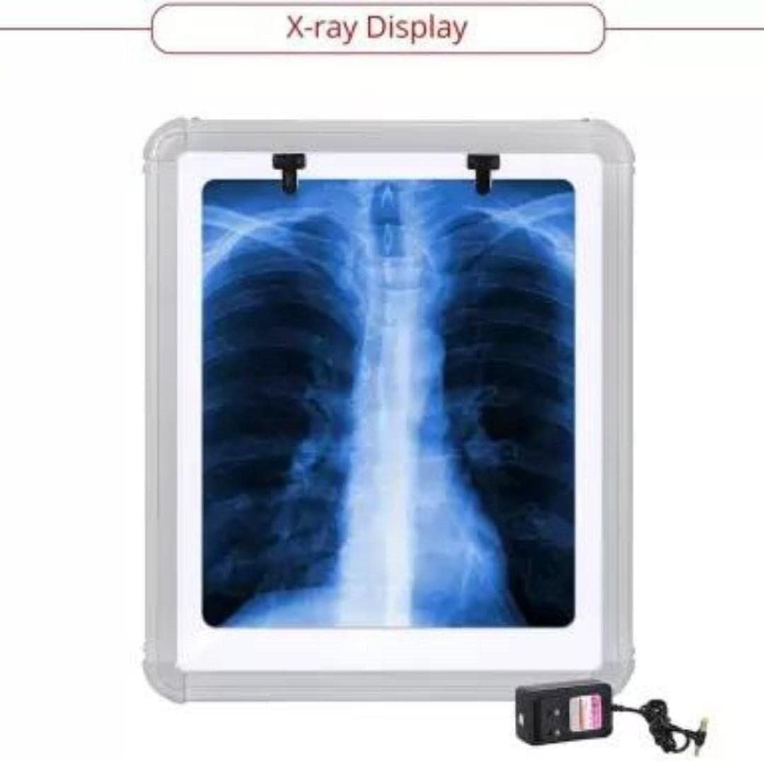 LED X-Ray View Box with Automatic Film Activation & Variable Brightness Control - Image 7
