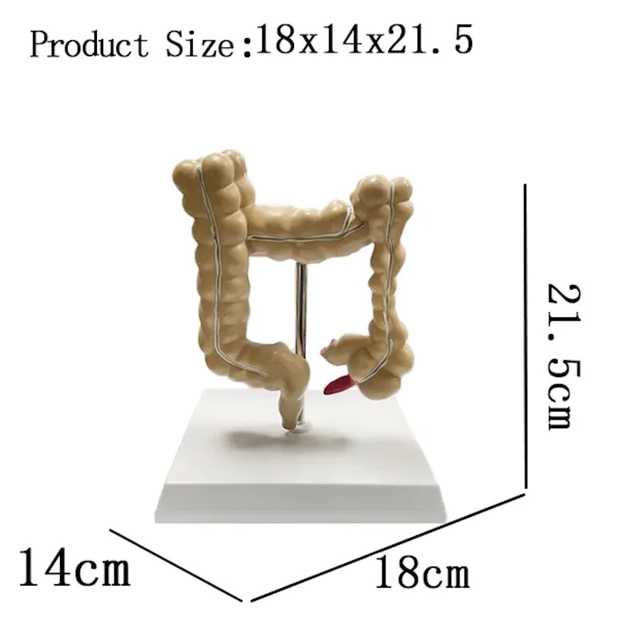 Human Intestine Anatomical Model with Pathologies – Premium Quality - Image 3