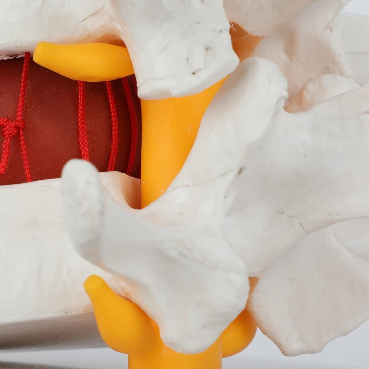 Human Lumbar Demonstration Model with Herniating Disc, Varied Textures - Image 4