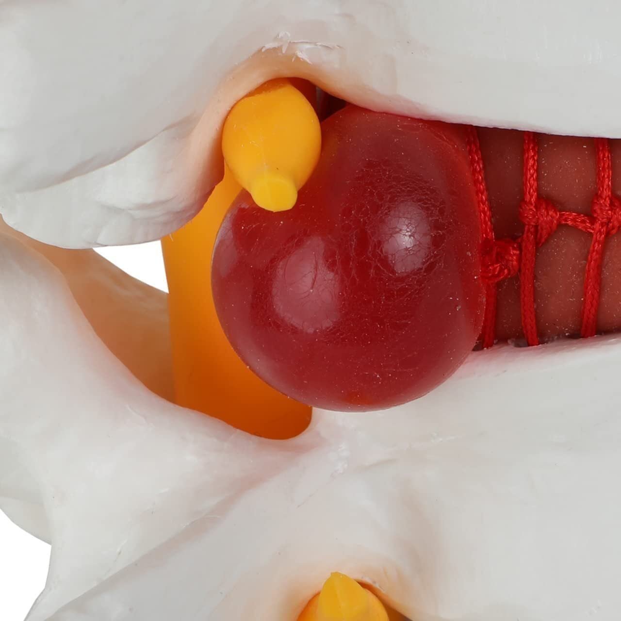 Human Lumbar Demonstration Model with Herniating Disc, Varied Textures - Image 3