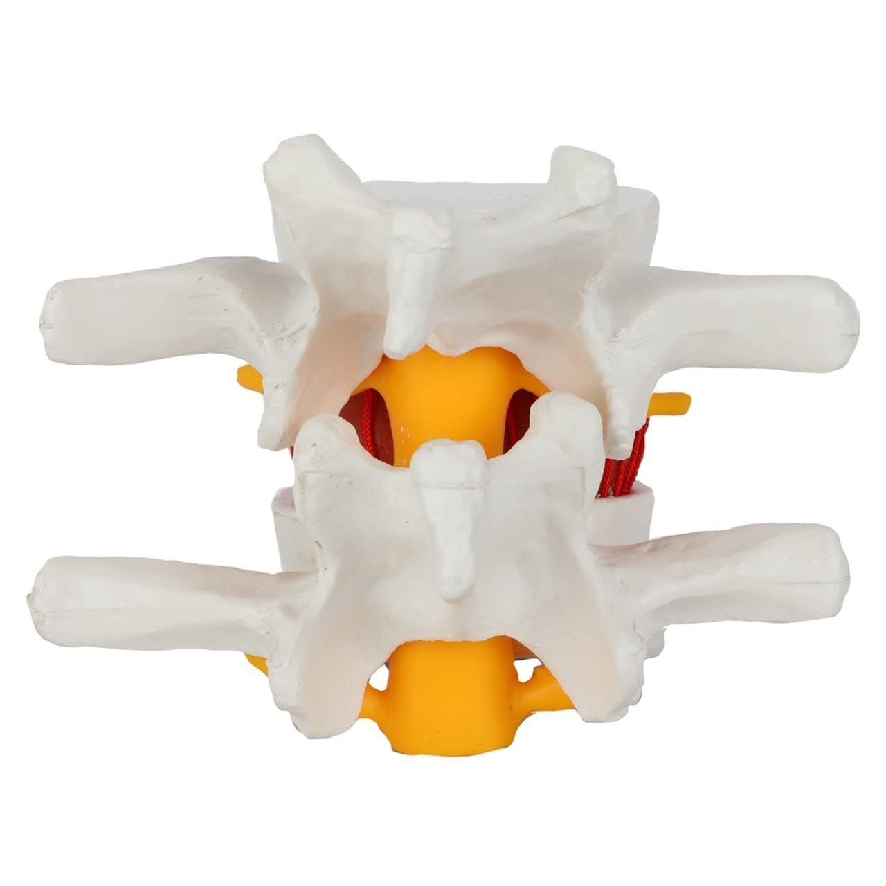 Human Lumbar Demonstration Model with Herniating Disc, Varied Textures - Image 6