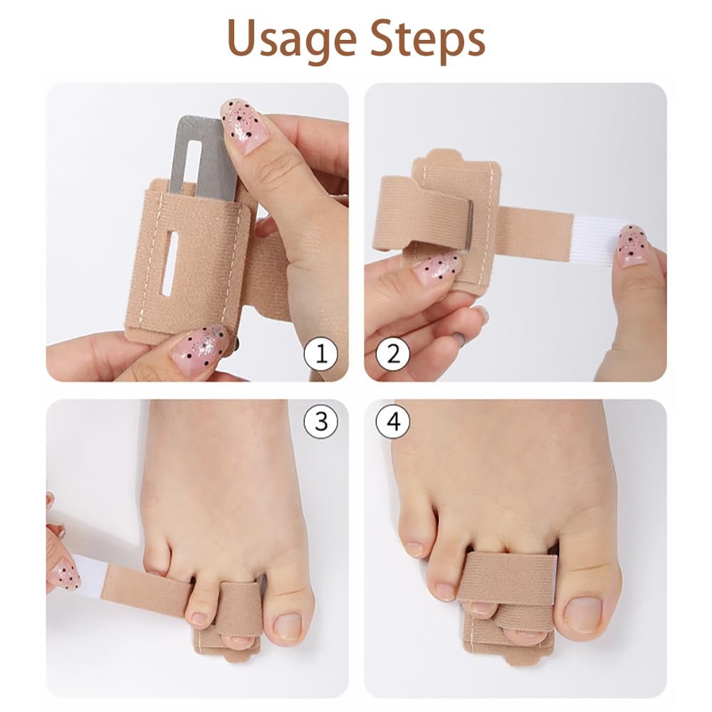 2pcs Hammer Toe Corrector for Women & Men, Reusable Fabric Hammer Toe Straightener for Broken Toes, Hammer Toe Splint Protector with Cushion Bandage - Image 6