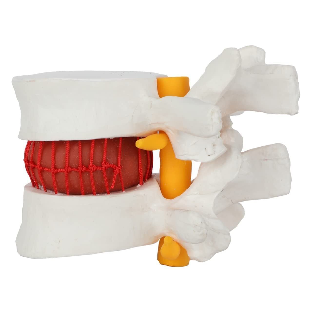 Human Lumbar Demonstration Model with Herniating Disc, Varied Textures - Image 2