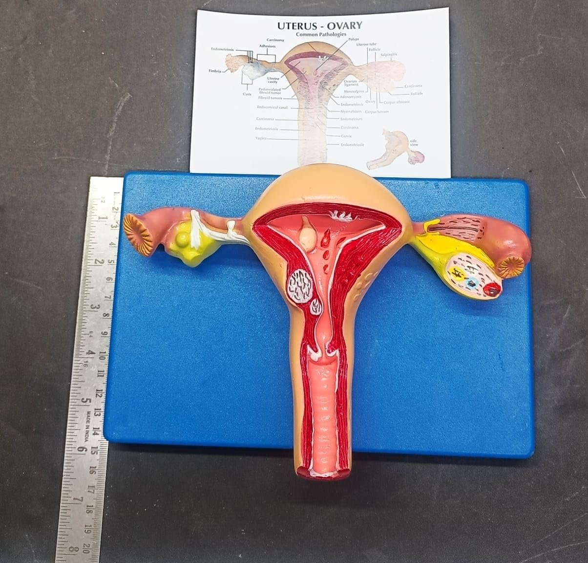 Uterus and Ovary Model Female Reproductive Organ Model - Image 2