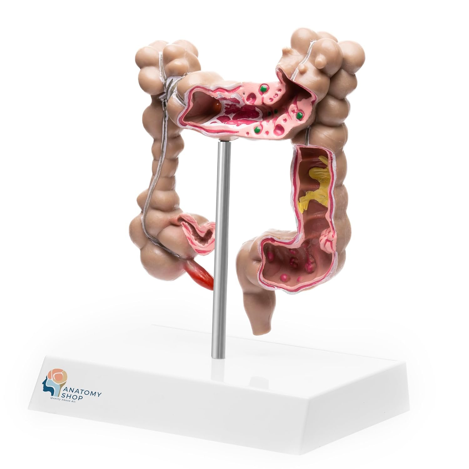 Human Intestine Anatomical Model with Pathologies – Premium Quality - Image 2