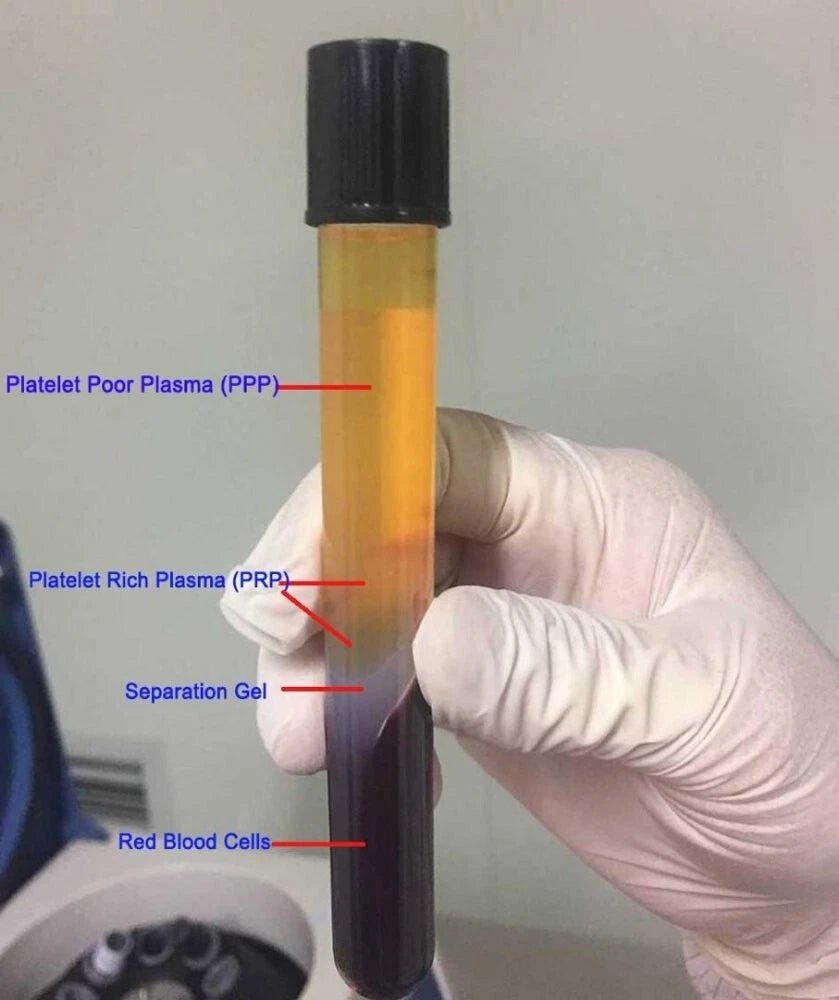 PRP Tube ACD Gel Biotin | Set of 50 Pieces - Image 5